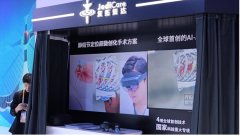 脉冲融系统做为首个进入国度药监局绿色审批通